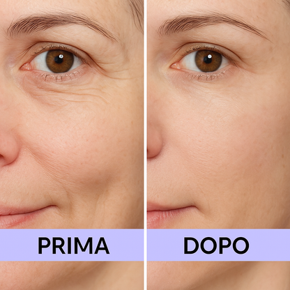 EyeLift Radiance – Sguardo riposato in pochi minuti